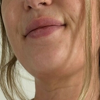 alexandramiddle Nøgen