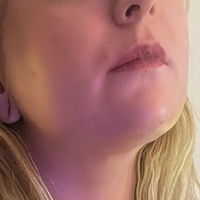 kichijotenxxx Nøgen