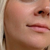 LactatingDaisy Nøgen