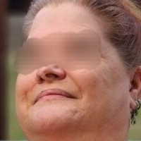 Summerzee Formerly Midwestcupl Nøgen